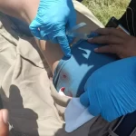 PERSONA LESIONADA POR BALINES EN LA CARRETERA TIZIMÍN-RÍO LAGARTOS